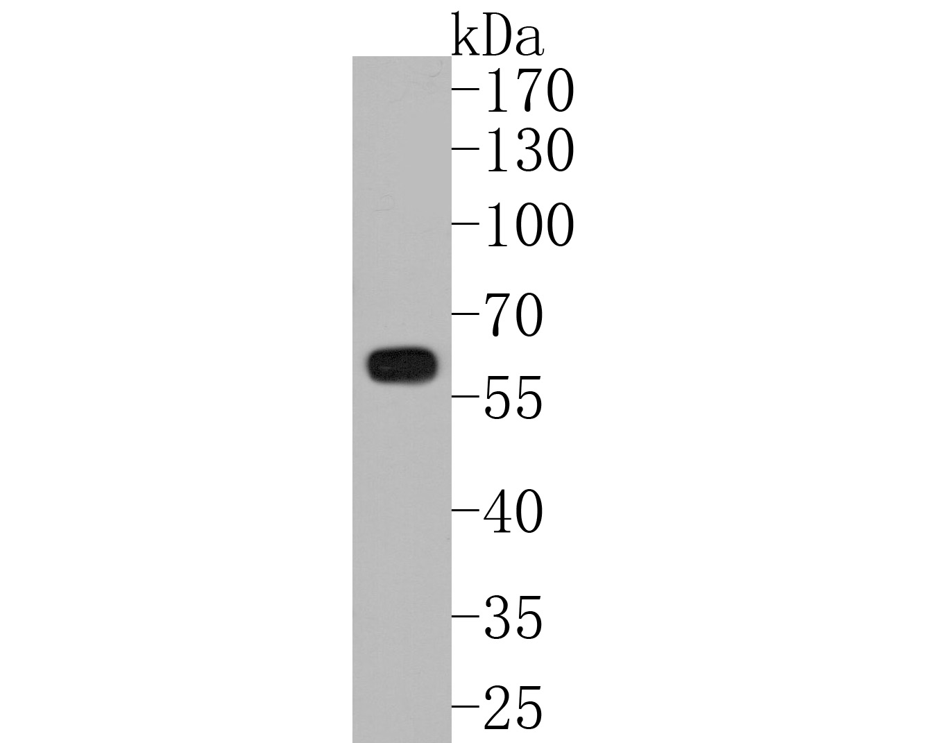 Western blot analysis of IRF5 on THP-1 cell lysates. Proteins were transferred to a PVDF membrane and blocked with 5% BSA in PBS for 1 hour at room temperature. The primary antibody (ET1611-94, 1/500) was used in 5% BSA at room temperature for 2 hours. Goat Anti-Rabbit IgG - HRP Secondary Antibody (HA1001) at 1:200,000 dilution was used for 1 hour at room temperature.