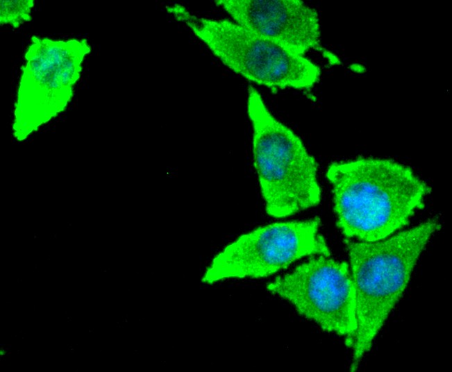 ICC staining of Tissue Factor in SH-SY5Y cells (green). Formalin fixed cells were permeabilized with 0.1% Triton X-100 in TBS for 10 minutes at room temperature and blocked with 1% Blocker BSA for 15 minutes at room temperature. Cells were probed with the primary antibody (ET1611-95, 1/50) for 1 hour at room temperature, washed with PBS. Alexa Fluor®488 Goat anti-Rabbit IgG was used as the secondary antibody at 1/1,000 dilution. The nuclear counter stain is DAPI (blue).