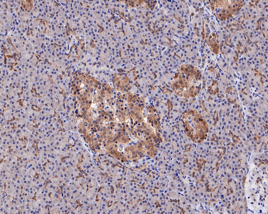 Immunohistochemical analysis of paraffin-embedded human pancreas tissue using anti-Tissue Factor antibody. The section was pre-treated using heat mediated antigen retrieval with Tris-EDTA buffer (pH 8.0-8.4) for 20 minutes.The tissues were blocked in 5% BSA for 30 minutes at room temperature, washed with ddH2O and PBS, and then probed with the primary antibody (ET1611-95, 1/50) for 30 minutes at room temperature. The detection was performed using an HRP conjugated compact polymer system. DAB was used as the chromogen. Tissues were counterstained with hematoxylin and mounted with DPX.