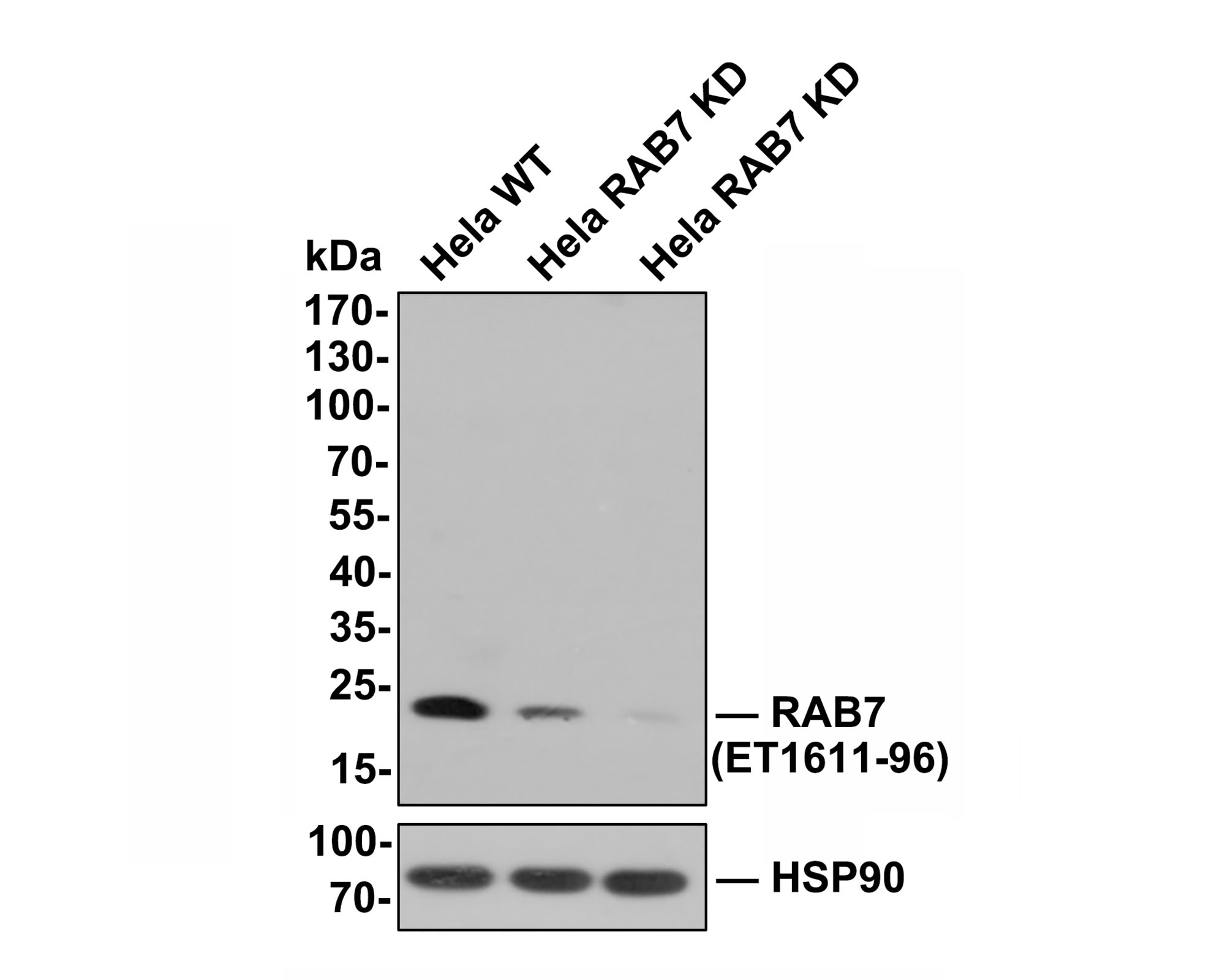 All lanes: Western blot analysis of RAB7 with anti-RAB7 antibody (ET1611-96) at 1:500 dilution.<br />
Lane 1: Wild-type Hela whole cell lysate (10 µg).<br />
Lane 2/3: RAB7 knockdown Hela whole cell lysate (10 µg).<br />
<br />
ET1611-96 was shown to specifically react with RAB7 in wild-type Hela cells. Weakened bands were observed when RAB7 knockdown samples were tested. Wild-type and RAB7 knockdown samples were subjected to SDS-PAGE. Proteins were transferred to a PVDF membrane and blocked with 5% NFDM in TBST for 1 hour at room temperature. The primary antibody (ET1611-96, 1:500) was used in 5% BSA at room temperature for 2 hours. Goat Anti-Rabbit IgG-HRP Secondary Antibody (HA1001) at 1:300,000 dilution was used for 1 hour at room temperature.