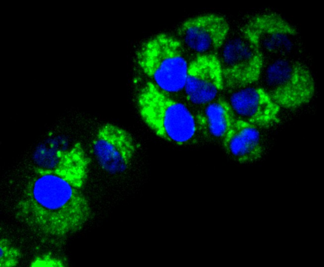 ICC staining of RAB7 in Hela cells (green). Formalin fixed cells were permeabilized with 0.1% Triton X-100 in TBS for 10 minutes at room temperature and blocked with 1% Blocker BSA for 15 minutes at room temperature. Cells were probed with the primary antibody (ET1611-96, 1/50) for 1 hour at room temperature, washed with PBS. Alexa Fluor®488 Goat anti-Rabbit IgG was used as the secondary antibody at 1/1,000 dilution. The nuclear counter stain is DAPI (blue).