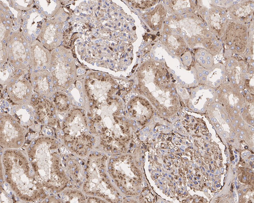 Immunohistochemical analysis of paraffin-embedded human kidney tissue with Rabbit anti-RAB7 antibody (ET1611-96) at 1/1,000 dilution.<br />
<br />
The section was pre-treated using heat mediated antigen retrieval with Tris-EDTA buffer (pH 9.0) for 20 minutes. The tissues were blocked in 1% BSA for 20 minutes at room temperature, washed with ddH2O and PBS, and then probed with the primary antibody (ET1611-96) at 1/1,000 dilution for 1 hour at room temperature. The detection was performed using an HRP conjugated compact polymer system. DAB was used as the chromogen. Tissues were counterstained with hematoxylin and mounted with DPX.