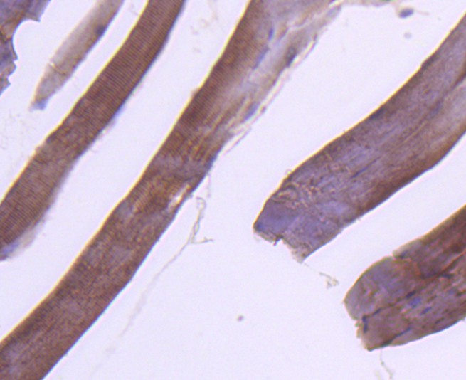 Immunohistochemical analysis of paraffin-embedded mouse skeletal tissue using anti-RAB7 antibody. The section was pre-treated using heat mediated antigen retrieval with Tris-EDTA buffer (pH 8.0-8.4) for 20 minutes.The tissues were blocked in 5% BSA for 30 minutes at room temperature, washed with ddH2O and PBS, and then probed with the primary antibody (ET1611-96, 1/50) for 30 minutes at room temperature. The detection was performed using an HRP conjugated compact polymer system. DAB was used as the chromogen. Tissues were counterstained with hematoxylin and mounted with DPX.