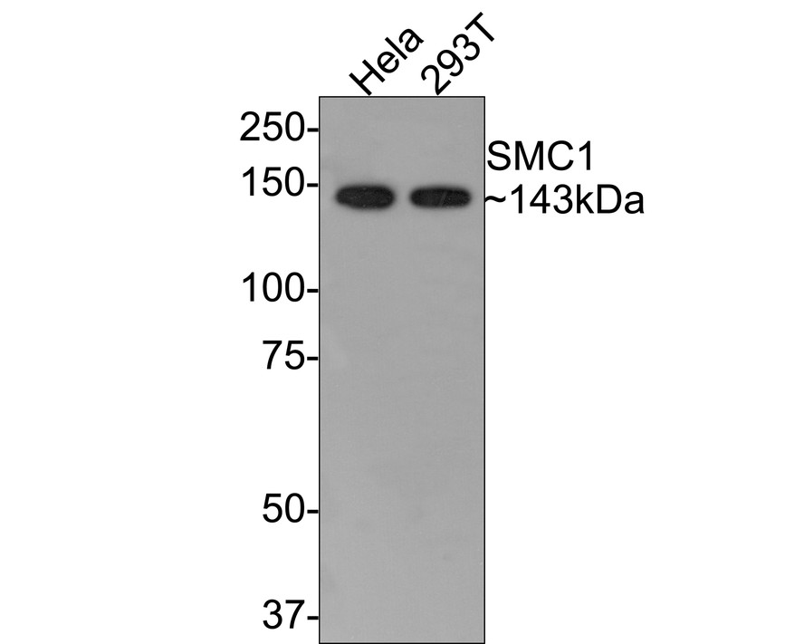 Western blot analysis of SMC1 on different lysates with Rabbit anti-SMC1 antibody (ET1611-97) at 1/500 dilution.<br />
<br />
Lane 1: Hela cell lysate<br />
Lane 2: 293T cell lysate<br />
<br />
Lysates/proteins at 10 µg/Lane.<br />
<br />
Predicted band size: 143 kDa<br />
Observed band size: 143 kDa<br />
<br />
Exposure time: 30 seconds;<br />
<br />
8% SDS-PAGE gel.<br />
<br />
Proteins were transferred to a PVDF membrane and blocked with 5% NFDM/TBST for 1 hour at room temperature. The primary antibody (ET1611-97) at 1/500 dilution was used in 5% NFDM/TBST at room temperature for 2 hours. Goat Anti-Rabbit IgG - HRP Secondary Antibody (HA1001) at 1:300,000 dilution was used for 1 hour at room temperature.