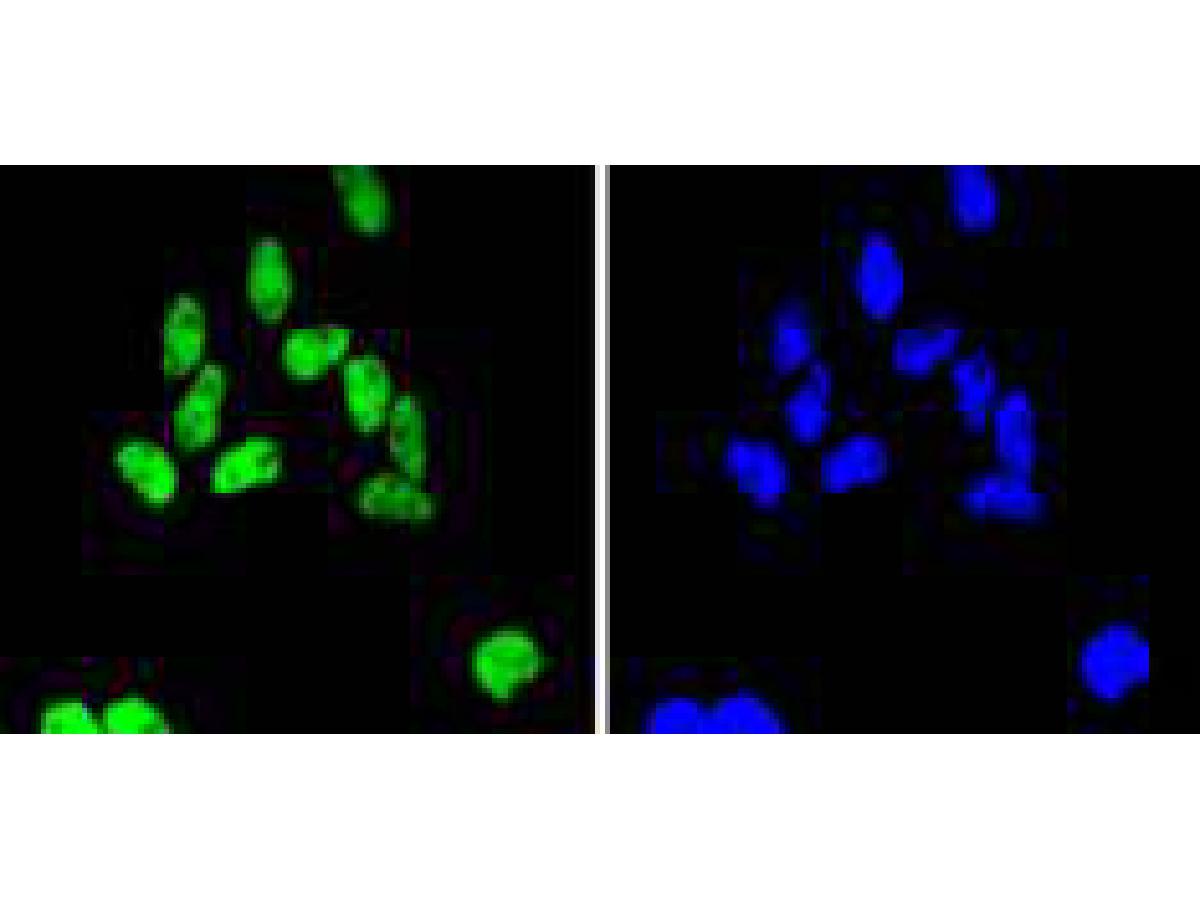 ICC staining of SMC1 in Hela cells (green). Formalin fixed cells were permeabilized with 0.1% Triton X-100 in TBS for 10 minutes at room temperature and blocked with 1% Blocker BSA for 15 minutes at room temperature. Cells were probed with the primary antibody (ET1611-97, 1/50) for 1 hour at room temperature, washed with PBS. Alexa Fluor®488 Goat anti-Rabbit IgG was used as the secondary antibody at 1/1,000 dilution. The nuclear counter stain is DAPI (blue).