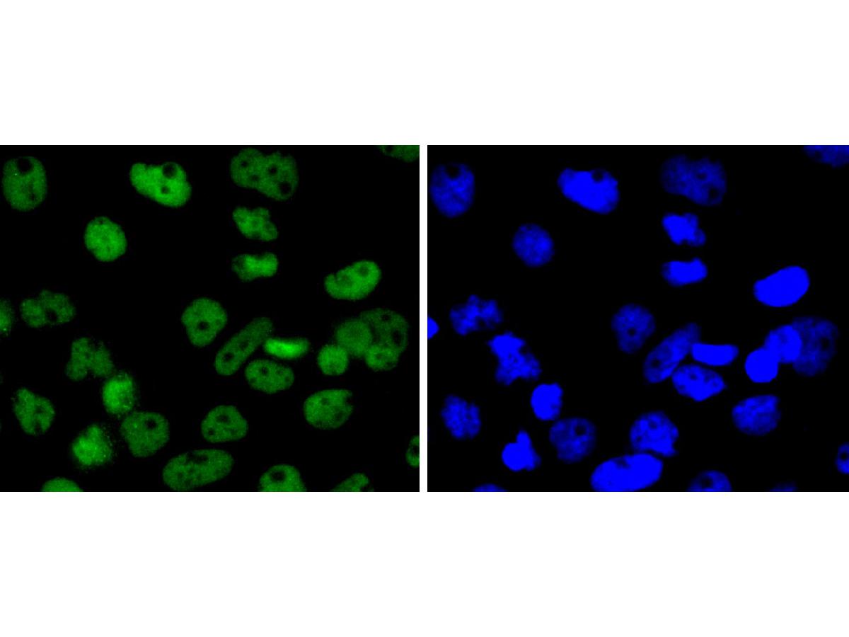 ICC staining of SMC1 in A431 cells (green). Formalin fixed cells were permeabilized with 0.1% Triton X-100 in TBS for 10 minutes at room temperature and blocked with 1% Blocker BSA for 15 minutes at room temperature. Cells were probed with the primary antibody (ET1611-97, 1/50) for 1 hour at room temperature, washed with PBS. Alexa Fluor®488 Goat anti-Rabbit IgG was used as the secondary antibody at 1/1,000 dilution. The nuclear counter stain is DAPI (blue).