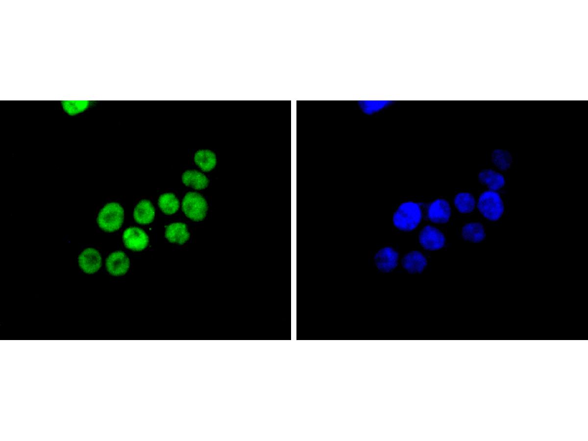 ICC staining of SMC1 in SW480 cells (green). Formalin fixed cells were permeabilized with 0.1% Triton X-100 in TBS for 10 minutes at room temperature and blocked with 1% Blocker BSA for 15 minutes at room temperature. Cells were probed with the primary antibody (ET1611-97, 1/50) for 1 hour at room temperature, washed with PBS. Alexa Fluor®488 Goat anti-Rabbit IgG was used as the secondary antibody at 1/1,000 dilution. The nuclear counter stain is DAPI (blue).