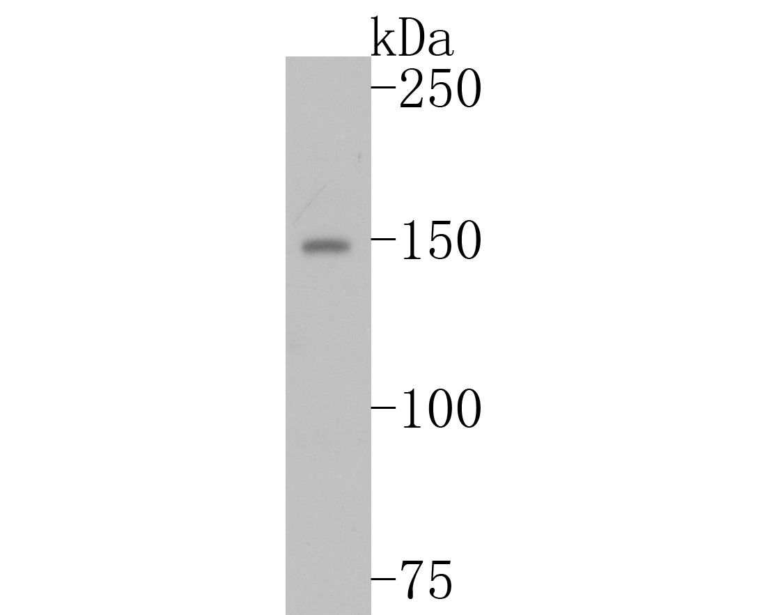 Western blot analysis of Ret on MCF-7 cell lysates. Proteins were transferred to a PVDF membrane and blocked with 5% BSA in PBS for 1 hour at room temperature. The primary antibody (ET1611-98, 1/500) was used in 5% BSA at room temperature for 2 hours. Goat Anti-Rabbit IgG - HRP Secondary Antibody (HA1001) at 1:5,000 dilution was used for 1 hour at room temperature.<br />
<br />
Predicted band size: 124 kDa<br />
Observed band size: 150 kDa