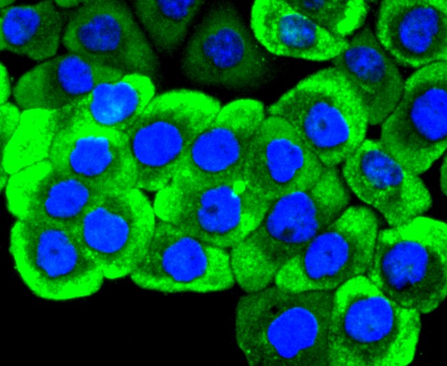 ICC staining of Ret in AGS cells (green). Formalin fixed cells were permeabilized with 0.1% Triton X-100 in TBS for 10 minutes at room temperature and blocked with 1% Blocker BSA for 15 minutes at room temperature. Cells were probed with the primary antibody (ET1611-98, 1/50) for 1 hour at room temperature, washed with PBS. Alexa Fluor®488 Goat anti-Rabbit IgG was used as the secondary antibody at 1/1,000 dilution. The nuclear counter stain is DAPI (blue).