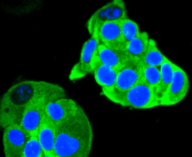 ICC staining of Ret in MCF-7 cells (green). Formalin fixed cells were permeabilized with 0.1% Triton X-100 in TBS for 10 minutes at room temperature and blocked with 1% Blocker BSA for 15 minutes at room temperature. Cells were probed with the primary antibody (ET1611-98, 1/50) for 1 hour at room temperature, washed with PBS. Alexa Fluor®488 Goat anti-Rabbit IgG was used as the secondary antibody at 1/1,000 dilution. The nuclear counter stain is DAPI (blue).