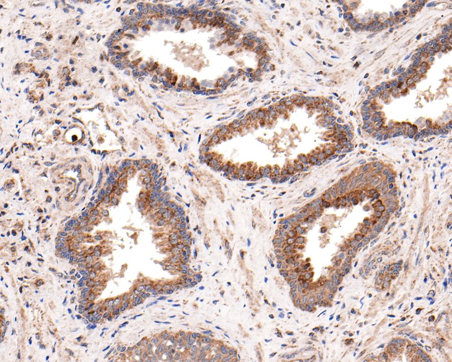 Immunohistochemical analysis of paraffin-embedded human prostate tissue with Rabbit anti-Ret antibody (ET1611-98) at 1/500 dilution.<br />
<br />
The section was pre-treated using heat mediated antigen retrieval with Tris-EDTA buffer (pH 9.0) for 20 minutes. The tissues were blocked in 1% BSA for 20 minutes at room temperature, washed with ddH2O and PBS, and then probed with the primary antibody (ET1611-98) at 1/500 dilution for 1 hour at room temperature. The detection was performed using an HRP conjugated compact polymer system. DAB was used as the chromogen. Tissues were counterstained with hematoxylin and mounted with DPX.