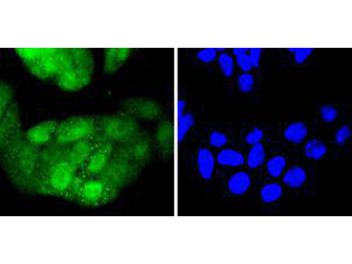 ICC staining of Cdk4 in Hela cells (green). Formalin fixed cells were permeabilized with 0.1% Triton X-100 in TBS for 10 minutes at room temperature and blocked with 1% Blocker BSA for 15 minutes at room temperature. Cells were probed with the primary antibody (ET1612-1, 1/50) for 1 hour at room temperature, washed with PBS. Alexa Fluor®488 Goat anti-Rabbit IgG was used as the secondary antibody at 1/1,000 dilution. The nuclear counter stain is DAPI (blue).