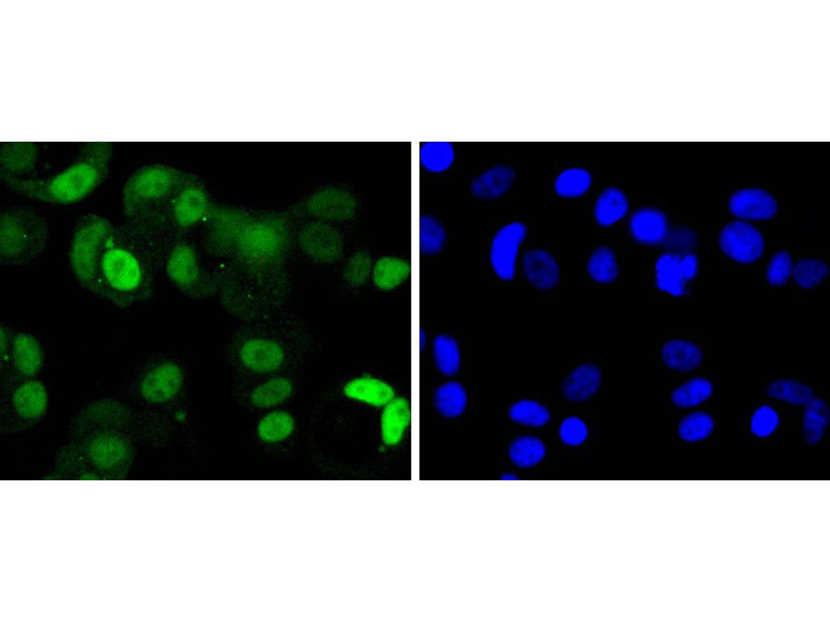 ICC staining of Cdk4 in MCF-7 cells (green). Formalin fixed cells were permeabilized with 0.1% Triton X-100 in TBS for 10 minutes at room temperature and blocked with 1% Blocker BSA for 15 minutes at room temperature. Cells were probed with the primary antibody (ET1612-1, 1/50) for 1 hour at room temperature, washed with PBS. Alexa Fluor®488 Goat anti-Rabbit IgG was used as the secondary antibody at 1/1,000 dilution. The nuclear counter stain is DAPI (blue).