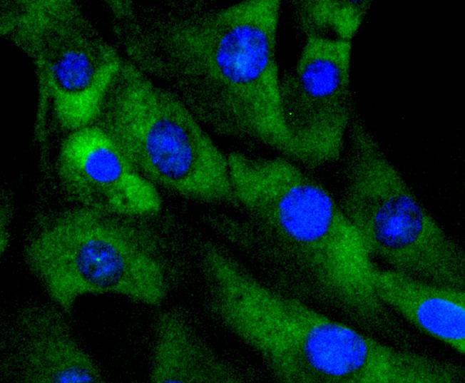 ICC staining of Cdk4 in NIH/3T3 cells (green). Formalin fixed cells were permeabilized with 0.1% Triton X-100 in TBS for 10 minutes at room temperature and blocked with 1% Blocker BSA for 15 minutes at room temperature. Cells were probed with the primary antibody (ET1612-1, 1/50) for 1 hour at room temperature, washed with PBS. Alexa Fluor®488 Goat anti-Rabbit IgG was used as the secondary antibody at 1/1,000 dilution. The nuclear counter stain is DAPI (blue).