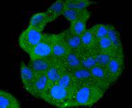 ICC staining of S100A4 in Hela cells (green). Formalin fixed cells were permeabilized with 0.1% Triton X-100 in TBS for 10 minutes at room temperature and blocked with 10% negative goat serum for 15 minutes at room temperature. Cells were probed with the primary antibody (ET1612-13, 1/50) for 1 hour at room temperature, washed with PBS. Alexa Fluor®488 conjugate-Goat anti-Rabbit IgG was used as the secondary antibody at 1/1,000 dilution. The nuclear counter stain is DAPI (blue).
