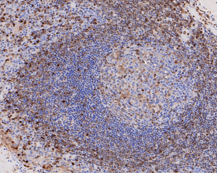 Immunohistochemical analysis of paraffin-embedded human tonsil tissue using anti-S100A4 antibody. The section was pre-treated using heat mediated antigen retrieval with Tris-EDTA buffer (pH 9.0) for 20 minutes.The tissues were blocked in 1% BSA for 30 minutes at room temperature, washed with ddH2O and PBS, and then probed with the primary antibody (ET1612-13, 1/200) for 30 minutes at room temperature. The detection was performed using an HRP conjugated compact polymer system. DAB was used as the chromogen. Tissues were counterstained with hematoxylin and mounted with DPX.