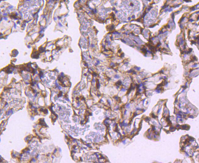 Immunohistochemical analysis of paraffin-embedded human lung tissue using anti-S100A4 antibody. The section was pre-treated using heat mediated antigen retrieval with Tris-EDTA buffer (pH 9.0) for 20 minutes.The tissues were blocked in 1% BSA for 30 minutes at room temperature, washed with ddH2O and PBS, and then probed with the primary antibody (ET1612-13, 1/50) for 30 minutes at room temperature. The detection was performed using an HRP conjugated compact polymer system. DAB was used as the chromogen. Tissues were counterstained with hematoxylin and mounted with DPX.
