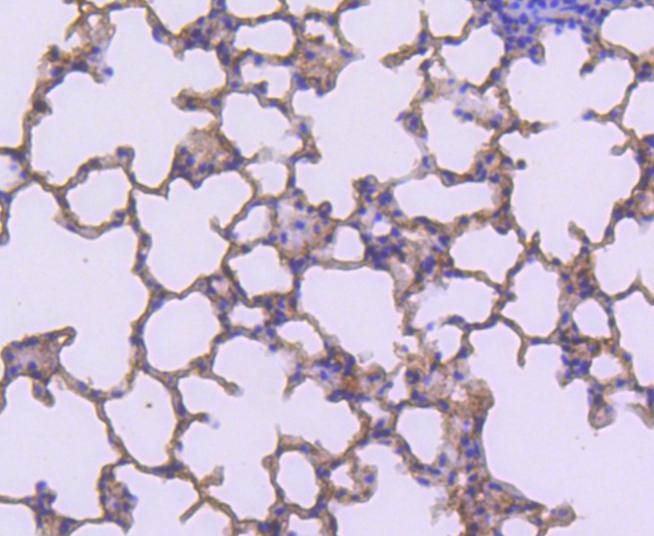 Immunohistochemical analysis of paraffin-embedded mouse lung tissue using anti-S100A4 antibody. The section was pre-treated using heat mediated antigen retrieval with Tris-EDTA buffer (pH 9.0) for 20 minutes.The tissues were blocked in 1% BSA for 30 minutes at room temperature, washed with ddH2O and PBS, and then probed with the primary antibody (ET1612-13, 1/50) for 30 minutes at room temperature. The detection was performed using an HRP conjugated compact polymer system. DAB was used as the chromogen. Tissues were counterstained with hematoxylin and mounted with DPX.