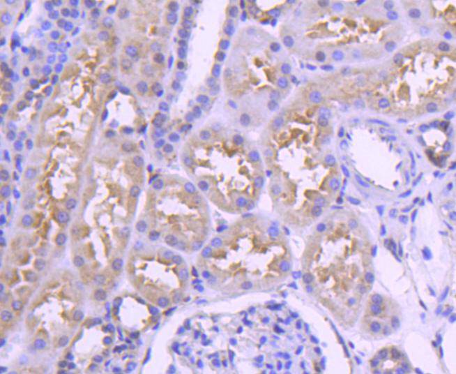 Immunohistochemical analysis of paraffin-embedded human kidney tissue using anti-IRF3 antibody. The section was pre-treated using heat mediated antigen retrieval with Tris-EDTA buffer (pH 8.0-8.4) for 20 minutes.The tissues were blocked in 5% BSA for 30 minutes at room temperature, washed with ddH2O and PBS, and then probed with the primary antibody (ET1612-14, 1/50) for 30 minutes at room temperature. The detection was performed using an HRP conjugated compact polymer system. DAB was used as the chromogen. Tissues were counterstained with hematoxylin and mounted with DPX.