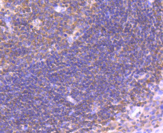 Immunohistochemical analysis of paraffin-embedded human tonsil tissue using anti-IRF3 antibody. The section was pre-treated using heat mediated antigen retrieval with Tris-EDTA buffer (pH 8.0-8.4) for 20 minutes.The tissues were blocked in 5% BSA for 30 minutes at room temperature, washed with ddH2O and PBS, and then probed with the primary antibody (ET1612-14, 1/50) for 30 minutes at room temperature. The detection was performed using an HRP conjugated compact polymer system. DAB was used as the chromogen. Tissues were counterstained with hematoxylin and mounted with DPX.