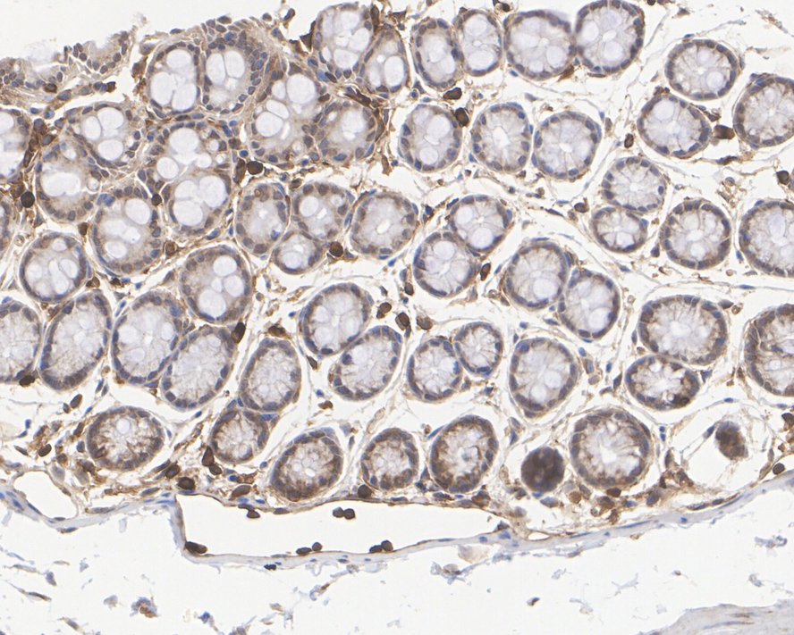 Immunohistochemical analysis of paraffin-embedded mouse spleen tissue using anti-IRF3 antibody. The section was pre-treated using heat mediated antigen retrieval with Tris-EDTA buffer (pH 8.0-8.4) for 20 minutes.The tissues were blocked in 5% BSA for 30 minutes at room temperature, washed with ddH2O and PBS, and then probed with the primary antibody (ET1612-14, 1/50) for 30 minutes at room temperature. The detection was performed using an HRP conjugated compact polymer system. DAB was used as the chromogen. Tissues were counterstained with hematoxylin and mounted with DPX.