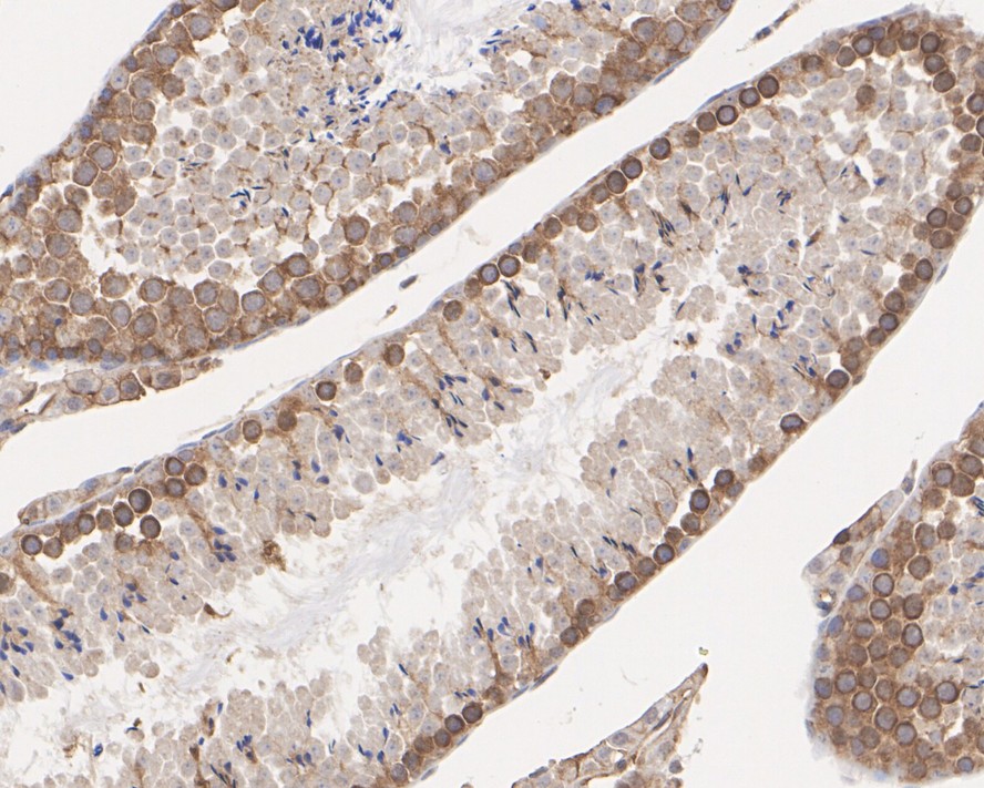 Immunohistochemical analysis of paraffin-embedded mouse kidney tissue using anti-IRF3 antibody. The section was pre-treated using heat mediated antigen retrieval with Tris-EDTA buffer (pH 8.0-8.4) for 20 minutes.The tissues were blocked in 5% BSA for 30 minutes at room temperature, washed with ddH2O and PBS, and then probed with the primary antibody (ET1612-14, 1/50) for 30 minutes at room temperature. The detection was performed using an HRP conjugated compact polymer system. DAB was used as the chromogen. Tissues were counterstained with hematoxylin and mounted with DPX.