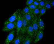 ICC staining of IRF5 in HepG2 cells (green). Formalin fixed cells were permeabilized with 0.1% Triton X-100 in TBS for 10 minutes at room temperature and blocked with 1% Blocker BSA for 15 minutes at room temperature. Cells were probed with the primary antibody (ET1612-15, 1/50) for 1 hour at room temperature, washed with PBS. Alexa Fluor®488 Goat anti-Rabbit IgG was used as the secondary antibody at 1/1,000 dilution. The nuclear counter stain is DAPI (blue).