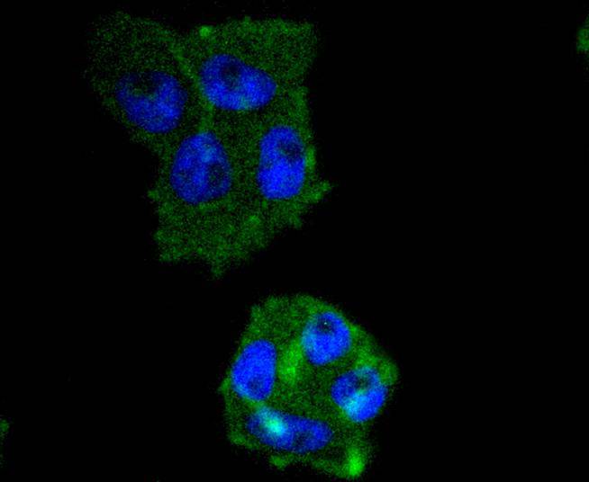 ICC staining of IRF5 in RH-35 cells (green). Formalin fixed cells were permeabilized with 0.1% Triton X-100 in TBS for 10 minutes at room temperature and blocked with 1% Blocker BSA for 15 minutes at room temperature. Cells were probed with the primary antibody (ET1612-15, 1/50) for 1 hour at room temperature, washed with PBS. Alexa Fluor®488 Goat anti-Rabbit IgG was used as the secondary antibody at 1/1,000 dilution. The nuclear counter stain is DAPI (blue).