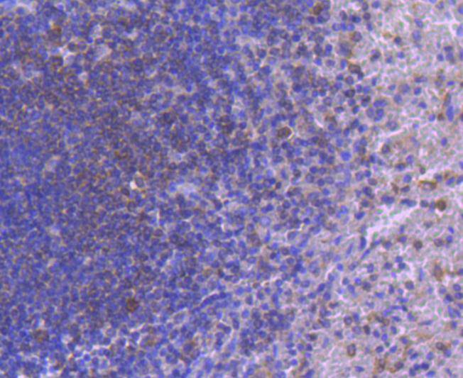 Immunohistochemical analysis of paraffin-embedded human spleen tissue using anti-IRF5 antibody. The section was pre-treated using heat mediated antigen retrieval with Tris-EDTA buffer (pH 8.0-8.4) for 20 minutes.The tissues were blocked in 5% BSA for 30 minutes at room temperature, washed with ddH2O and PBS, and then probed with the primary antibody (ET1612-15, 1/50) for 30 minutes at room temperature. The detection was performed using an HRP conjugated compact polymer system. DAB was used as the chromogen. Tissues were counterstained with hematoxylin and mounted with DPX.