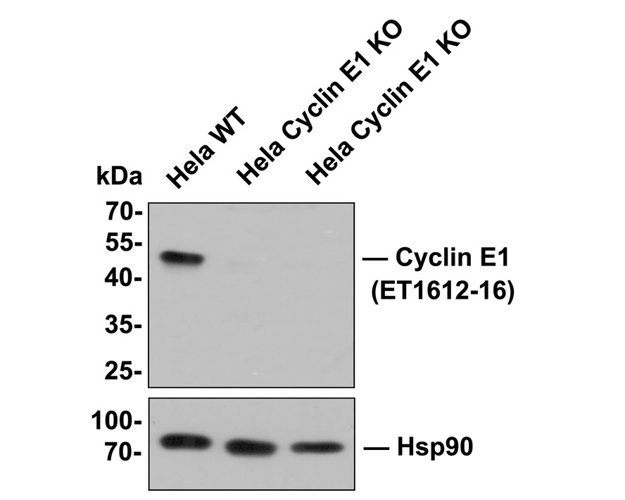 All lanes: Western blot analysis of Cyclin E1 with anti-Cyclin E1 antibody[SD20-24]  (ET1612-16) at 1:500 dilution.<br />
Lane 1: Wild-type Hela whole cell lysate (10 µg).<br />
Lane 2/3: Cyclin E1 knockout Hela whole cell lysate (10 µg).<br />
<br />
ET1612-16 was shown to specifically react with Cyclin E1 in wild-type Hela cells. No bands were observed when Cyclin E1 knockout sample were tested. Wild-type and Cyclin E1 knockout samples were subjected to SDS-PAGE. Proteins were transferred to a PVDF membrane and blocked with 5% NFDM in TBST for 1 hour at room temperature. The primary antibody (ET1612-16, 1/500) was used in 5% BSA at room temperature for 2 hours. Goat Anti-Rabbit IgG-HRP Secondary Antibody (HA1001) at 1:200,000 dilution was used for 1 hour at room temperature.