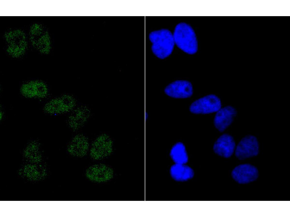 ICC staining of Cyclin E1 in Hela cells (green). Formalin fixed cells were permeabilized with 0.1% Triton X-100 in TBS for 10 minutes at room temperature and blocked with 1% Blocker BSA for 15 minutes at room temperature. Cells were probed with the primary antibody (ET1612-16, 1/50) for 1 hour at room temperature, washed with PBS. Alexa Fluor®488 Goat anti-Rabbit IgG was used as the secondary antibody at 1/1,000 dilution. The nuclear counter stain is DAPI (blue).