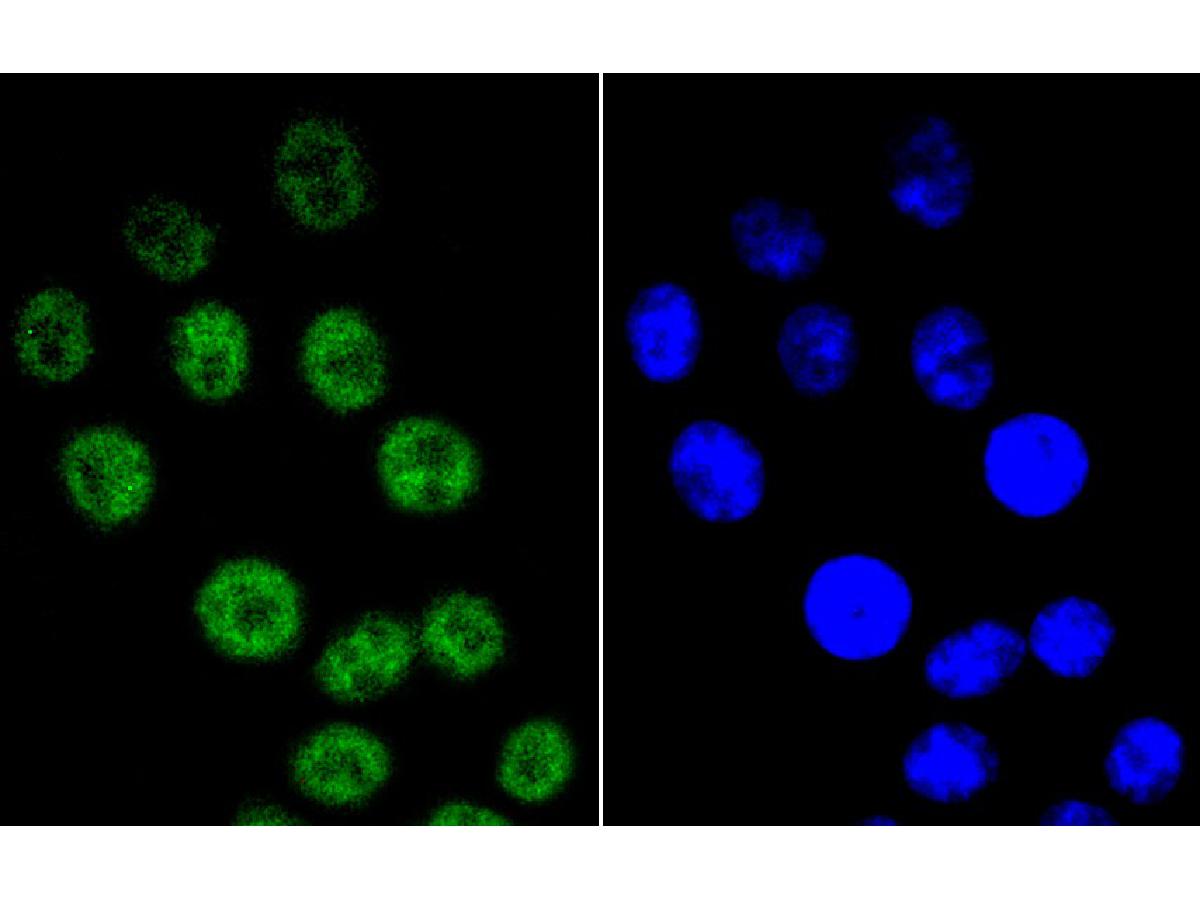 ICC staining of Cyclin E1 in HepG2 cells (green). Formalin fixed cells were permeabilized with 0.1% Triton X-100 in TBS for 10 minutes at room temperature and blocked with 1% Blocker BSA for 15 minutes at room temperature. Cells were probed with the primary antibody (ET1612-16, 1/50) for 1 hour at room temperature, washed with PBS. Alexa Fluor®488 Goat anti-Rabbit IgG was used as the secondary antibody at 1/1,000 dilution. The nuclear counter stain is DAPI (blue).