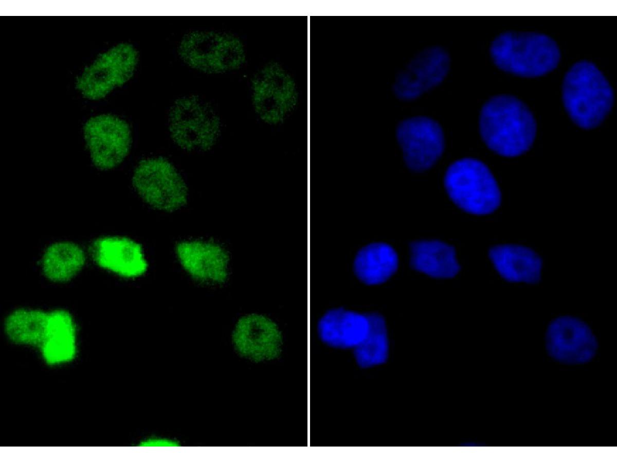 ICC staining of Cyclin E1 in MCF-7 cells (green). Formalin fixed cells were permeabilized with 0.1% Triton X-100 in TBS for 10 minutes at room temperature and blocked with 1% Blocker BSA for 15 minutes at room temperature. Cells were probed with the primary antibody (ET1612-16, 1/50) for 1 hour at room temperature, washed with PBS. Alexa Fluor®488 Goat anti-Rabbit IgG was used as the secondary antibody at 1/1,000 dilution. The nuclear counter stain is DAPI (blue).