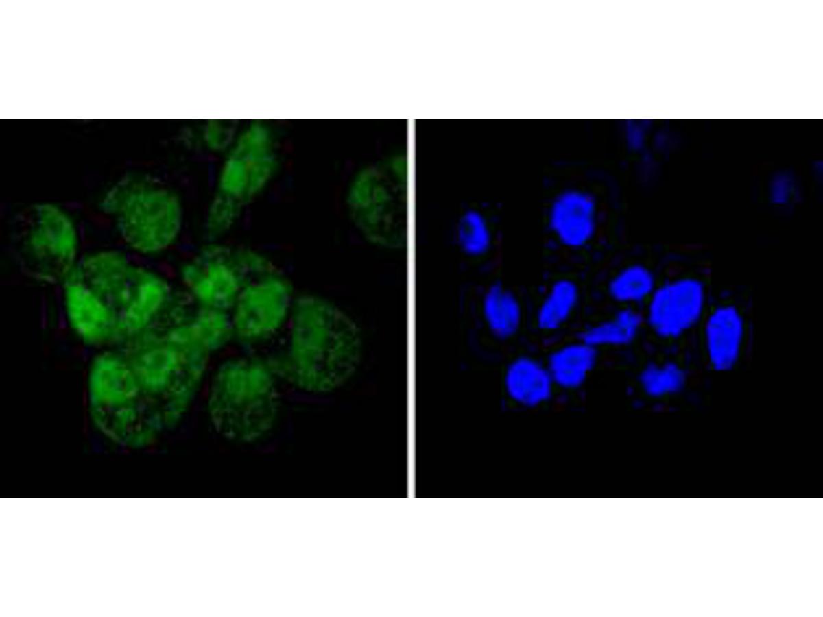 ICC staining of Cyclin E2 in Hela cells (green). Formalin fixed cells were permeabilized with 0.1% Triton X-100 in TBS for 10 minutes at room temperature and blocked with 1% Blocker BSA for 15 minutes at room temperature. Cells were probed with the primary antibody (ET1612-17, 1/500) for 1 hour at room temperature, washed with PBS. Alexa Fluor®488 Goat anti-Rabbit IgG was used as the secondary antibody at 1/1,000 dilution. The nuclear counter stain is DAPI (blue).