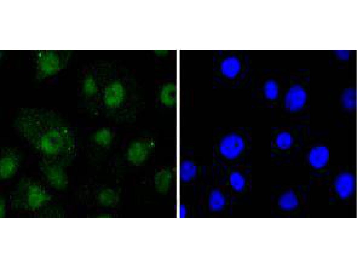 ICC staining of RelB in SW480 cells (green). Formalin fixed cells were permeabilized with 0.1% Triton X-100 in TBS for 10 minutes at room temperature and blocked with 1% Blocker BSA for 15 minutes at room temperature. Cells were probed with the primary antibody (ET1612-18, 1/50) for 1 hour at room temperature, washed with PBS. Alexa Fluor®488 Goat anti-Rabbit IgG was used as the secondary antibody at 1/1,000 dilution. The nuclear counter stain is DAPI (blue).