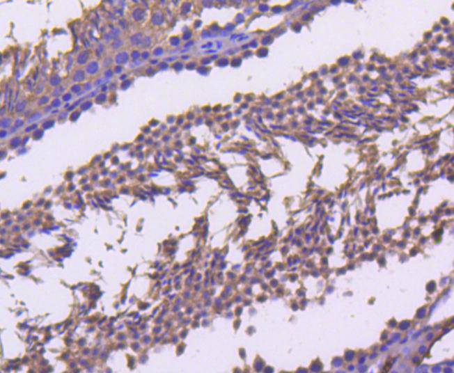 Immunohistochemical analysis of paraffin-embedded mouse colon tissue using anti-Cyclin B2 antibody. The section was pre-treated using heat mediated antigen retrieval with Tris-EDTA buffer (pH 9.0) for 20 minutes.The tissues were blocked in 5% BSA for 30 minutes at room temperature, washed with ddH2O and PBS, and then probed with the primary antibody (ET1612-21, 1/50) for 30 minutes at room temperature. The detection was performed using an HRP conjugated compact polymer system. DAB was used as the chromogen. Tissues were counterstained with hematoxylin and mounted with DPX.