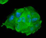 ICC staining of STAT1 alpha in Hela cells (green). Formalin fixed cells were permeabilized with 0.1% Triton X-100 in TBS for 10 minutes at room temperature and blocked with 10% negative goat serum for 15 minutes at room temperature. Cells were probed with the primary antibody (ET1612-22, 1/50) for 1 hour at room temperature, washed with PBS. Alexa Fluor®488 conjugate-Goat anti-Rabbit IgG was used as the secondary antibody at 1/1,000 dilution. The nuclear counter stain is DAPI (blue).