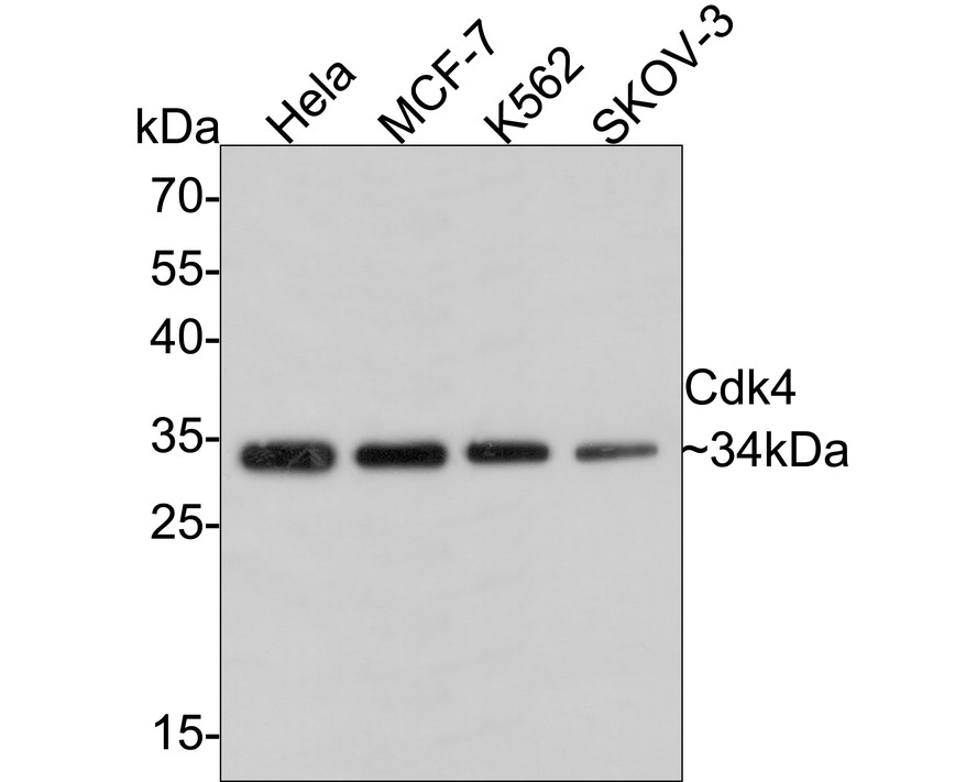Western blot analysis of Cdk4 on different lysates with Rabbit anti-Cdk4 antibody (ET1612-23) at 1/1,000 dilution.<br />
<br />
Lane 1: Hela cell lysate<br />
Lane 2: MCF-7 cell lysate<br />
Lane 3: K562 cell lysate<br />
Lane 4: SKOV-3 cell lysate<br />
<br />
Lysates/proteins at 10 µg/Lane.<br />
<br />
Predicted band size: 34 kDa<br />
Observed band size: 34 kDa<br />
<br />
Exposure time: 2 minutes;<br />
<br />
12% SDS-PAGE gel.<br />
<br />
Proteins were transferred to a PVDF membrane and blocked with 5% NFDM/TBST for 1 hour at room temperature. The primary antibody (ET1612-23) at 1/1,000 dilution was used in 5% NFDM/TBST at room temperature for 2 hours. Goat Anti-Rabbit IgG - HRP Secondary Antibody (HA1001) at 1:300,000 dilution was used for 1 hour at room temperature.