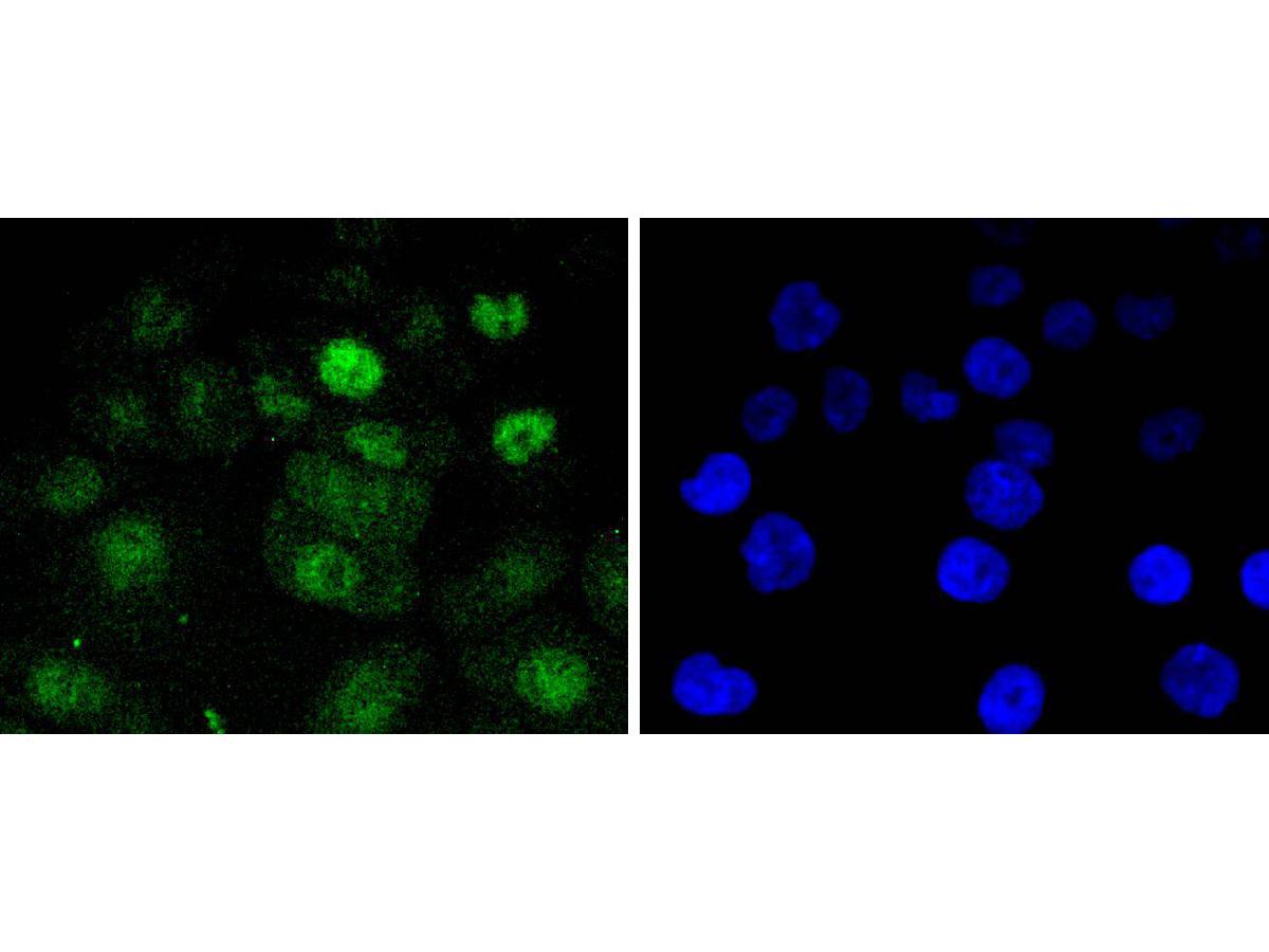 ICC staining of Cdk4 in AGS cells (green). Formalin fixed cells were permeabilized with 0.1% Triton X-100 in TBS for 10 minutes at room temperature and blocked with 1% Blocker BSA for 15 minutes at room temperature. Cells were probed with the primary antibody (ET1612-23, 1/50) for 1 hour at room temperature, washed with PBS. Alexa Fluor®488 Goat anti-Rabbit IgG was used as the secondary antibody at 1/1,000 dilution. The nuclear counter stain is DAPI (blue).