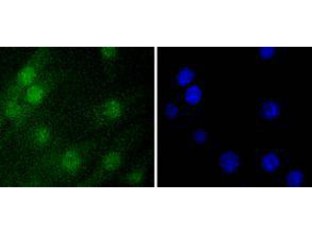 ICC staining of Histone H1.0 in NIH/3T3 cells (green). Formalin fixed cells were permeabilized with 0.1% Triton X-100 in TBS for 10 minutes at room temperature and blocked with 1% Blocker BSA for 15 minutes at room temperature. Cells were probed with the primary antibody (ET1612-24, 1/50) for 1 hour at room temperature, washed with PBS. Alexa Fluor®488 Goat anti-Rabbit IgG was used as the secondary antibody at 1/1,000 dilution. The nuclear counter stain is DAPI (blue).