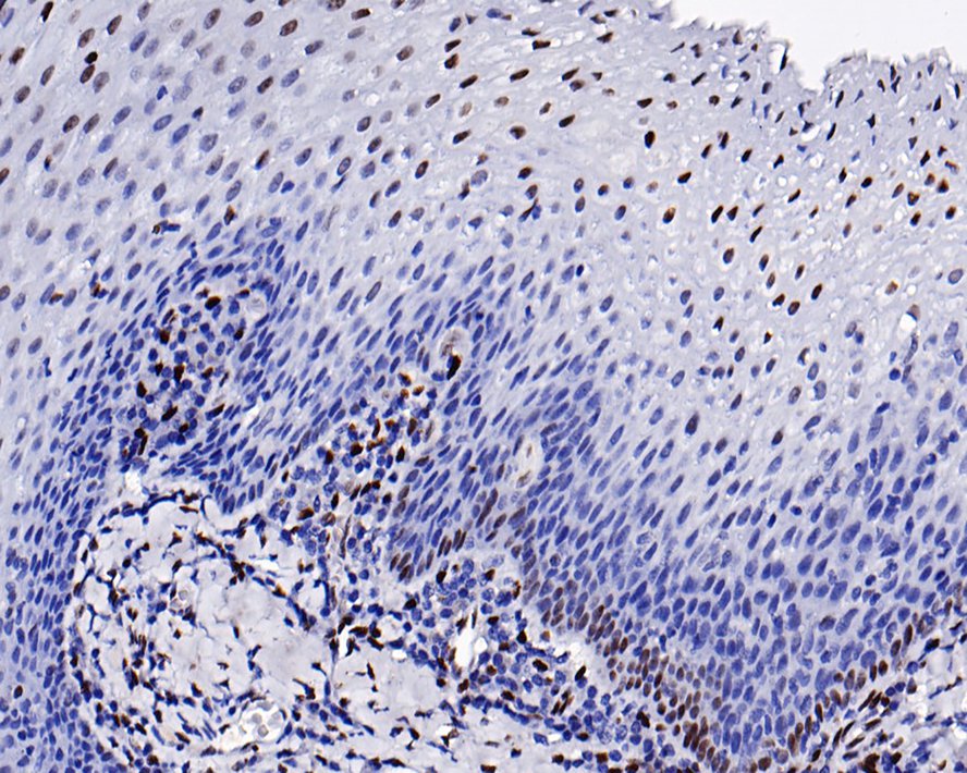 Immunohistochemical analysis of paraffin-embedded human tonsil tissue with Rabbit anti-Histone H1.0 antibody (ET1612-24) at 1/200 dilution.<br />
<br />
The section was pre-treated using heat mediated antigen retrieval with Tris-EDTA buffer (pH 9.0) for 20 minutes. The tissues were blocked in 1% BSA for 20 minutes at room temperature, washed with ddH2O and PBS, and then probed with the primary antibody (ET1612-24) at 1/200 dilution for 1 hour at room temperature. The detection was performed using an HRP conjugated compact polymer system. DAB was used as the chromogen. Tissues were counterstained with hematoxylin and mounted with DPX.