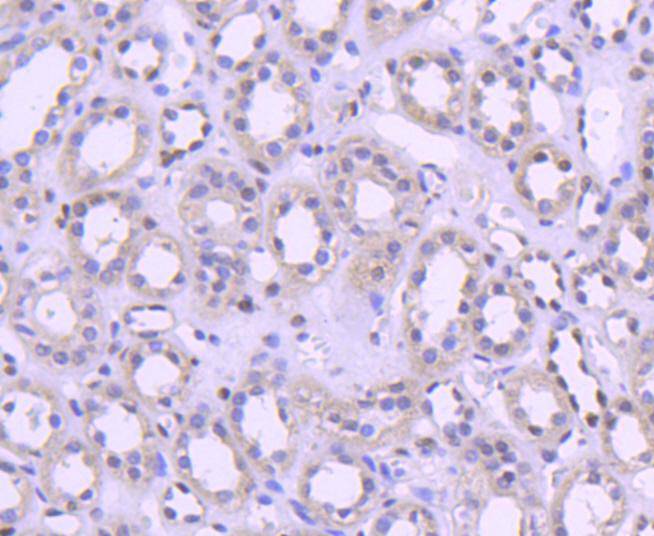 Immunohistochemical analysis of paraffin-embedded human kidney tissue using anti-Histone H1.0 antibody. The section was pre-treated using heat mediated antigen retrieval with Tris-EDTA buffer (pH 8.0-8.4) for 20 minutes.The tissues were blocked in 5% BSA for 30 minutes at room temperature, washed with ddH2O and PBS, and then probed with the primary antibody (ET1612-24, 1/50) for 30 minutes at room temperature. The detection was performed using an HRP conjugated compact polymer system. DAB was used as the chromogen. Tissues were counterstained with hematoxylin and mounted with DPX.