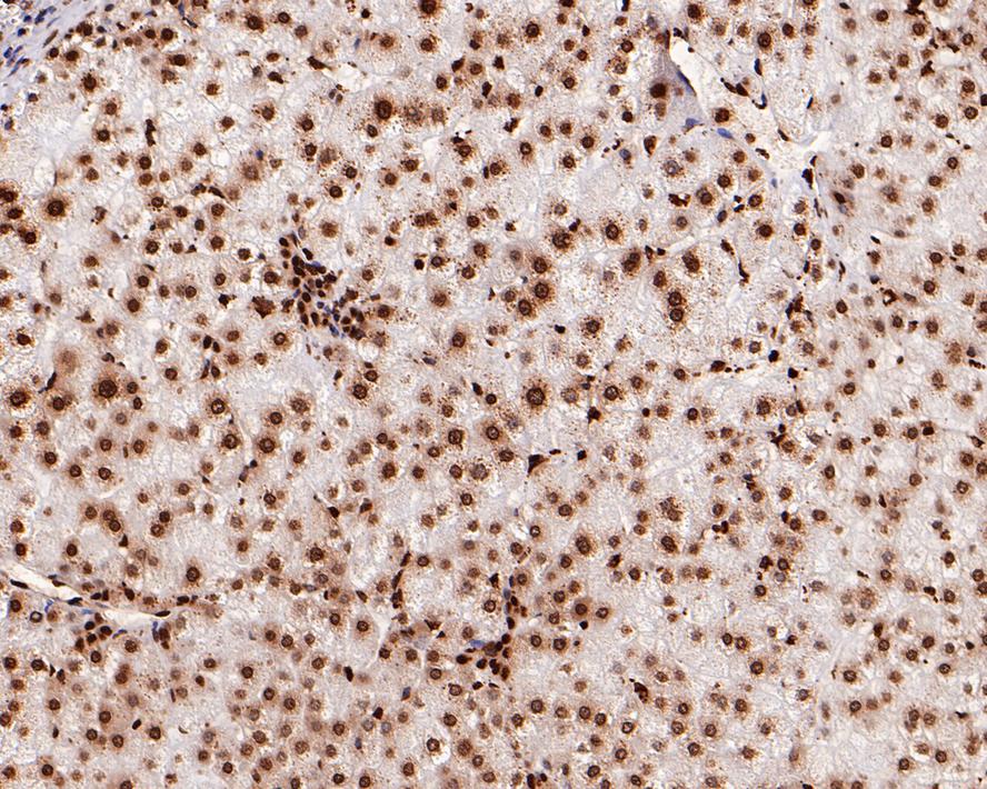 Immunohistochemical analysis of paraffin-embedded human liver tissue using anti-Histone H2B antibody. The section was pre-treated using heat mediated antigen retrieval with Tris-EDTA buffer (pH 8.0-8.4) for 20 minutes.The tissues were blocked in 5% BSA for 30 minutes at room temperature, washed with ddH2O and PBS, and then probed with the primary antibody (ET1612-25, 1/50) for 30 minutes at room temperature. The detection was performed using an HRP conjugated compact polymer system. DAB was used as the chromogen. Tissues were counterstained with hematoxylin and mounted with DPX.