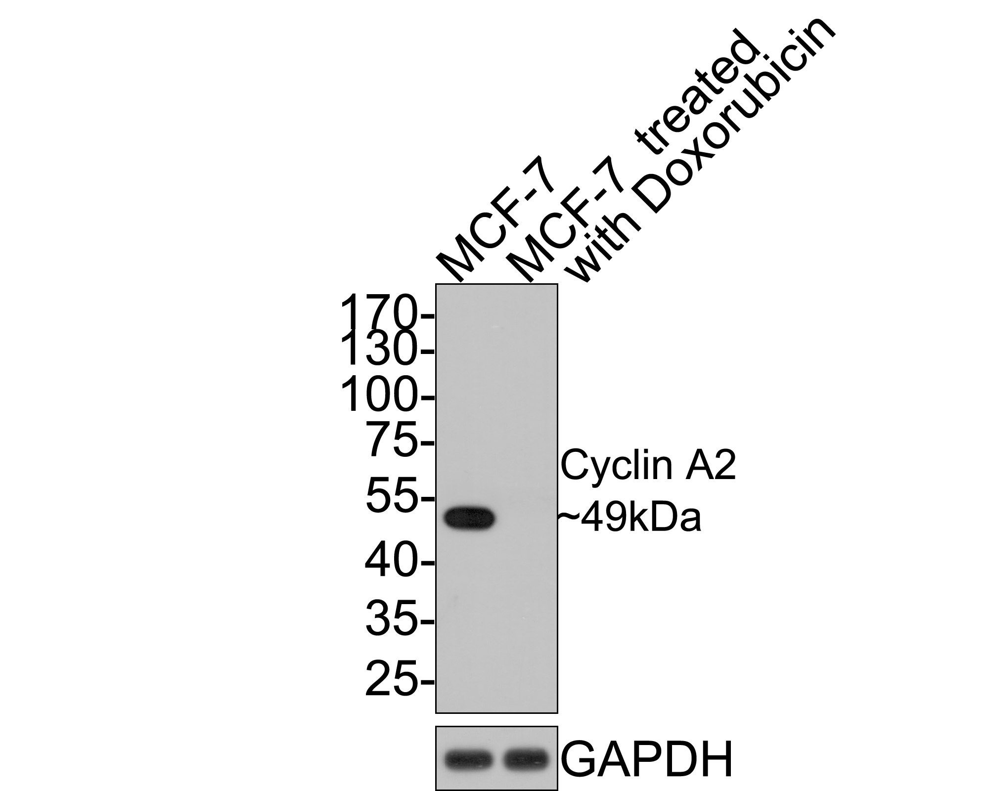 Western blot analysis of Cyclin A2 on different lysates with Rabbit anti-Cyclin A2 antibody (ET1612-26) at 1/500 dilution.<br />
<br />
Lane 1: MCF-7 cell lysate<br />
Lane 2: MCF-7 treated with doxorubicin cell lysate<br />
<br />
Lysates/proteins at 10 µg/Lane.<br />
<br />
Predicted band size: 49 kDa<br />
Observed band size: 49 kDa<br />
<br />
Exposure time: 2 minutes;<br />
<br />
10% SDS-PAGE gel.<br />
<br />
Proteins were transferred to a PVDF membrane and blocked with 5% NFDM/TBST for 1 hour at room temperature. The primary antibody (ET1612-26) at 1/500 dilution was used in 5% NFDM/TBST at room temperature for 2 hours. Goat Anti-Rabbit IgG - HRP Secondary Antibody (HA1001) at 1:300,000 dilution was used for 1 hour at room temperature.