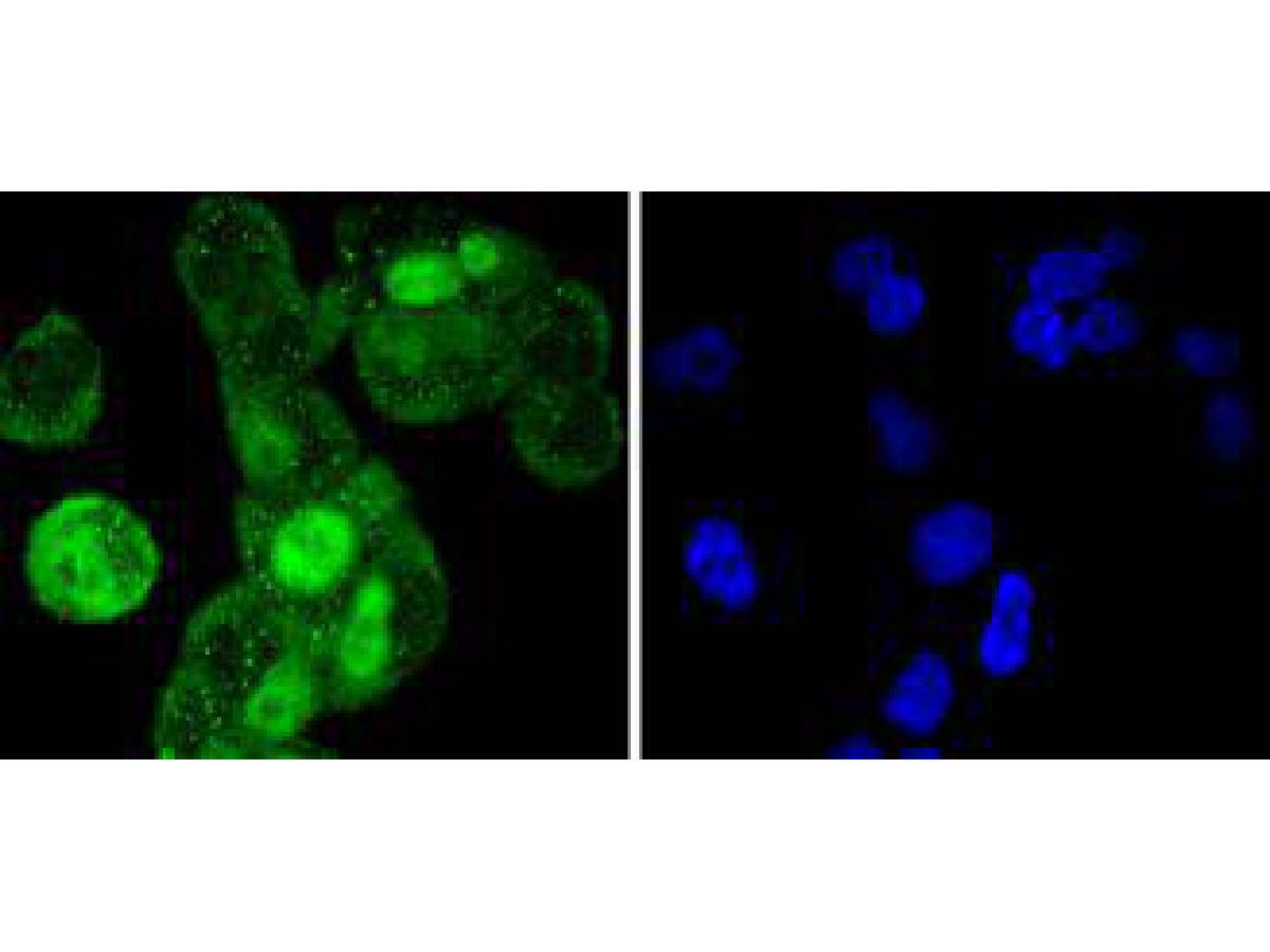 ICC staining of Cyclin A2 in Hela cells (green). Formalin fixed cells were permeabilized with 0.1% Triton X-100 in TBS for 10 minutes at room temperature and blocked with 1% Blocker BSA for 15 minutes at room temperature. Cells were probed with the primary antibody (ET1612-26, 1/50) for 1 hour at room temperature, washed with PBS. Alexa Fluor®488 Goat anti-Rabbit IgG was used as the secondary antibody at 1/1,000 dilution. The nuclear counter stain is DAPI (blue).