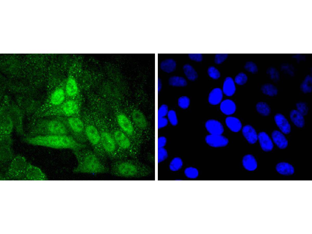 ICC staining of Cyclin A2 in HepG2 cells (green). Formalin fixed cells were permeabilized with 0.1% Triton X-100 in TBS for 10 minutes at room temperature and blocked with 1% Blocker BSA for 15 minutes at room temperature. Cells were probed with the primary antibody (ET1612-26, 1/50) for 1 hour at room temperature, washed with PBS. Alexa Fluor®488 Goat anti-Rabbit IgG was used as the secondary antibody at 1/1,000 dilution. The nuclear counter stain is DAPI (blue).