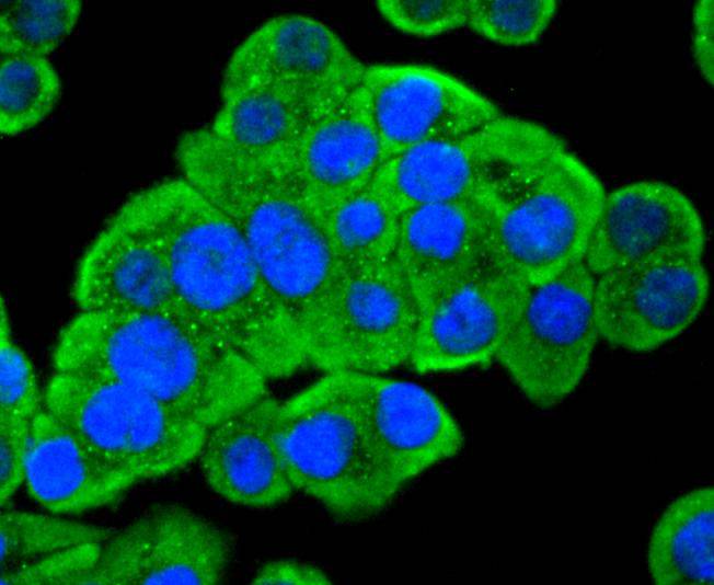 ICC staining of PDPK1 in SW480 cells (green). Formalin fixed cells were permeabilized with 0.1% Triton X-100 in TBS for 10 minutes at room temperature and blocked with 1% Blocker BSA for 15 minutes at room temperature. Cells were probed with the primary antibody (ET1612-27, 1/200) for 1 hour at room temperature, washed with PBS. Alexa Fluor®488 Goat anti-Rabbit IgG was used as the secondary antibody at 1/1,000 dilution. The nuclear counter stain is DAPI (blue).