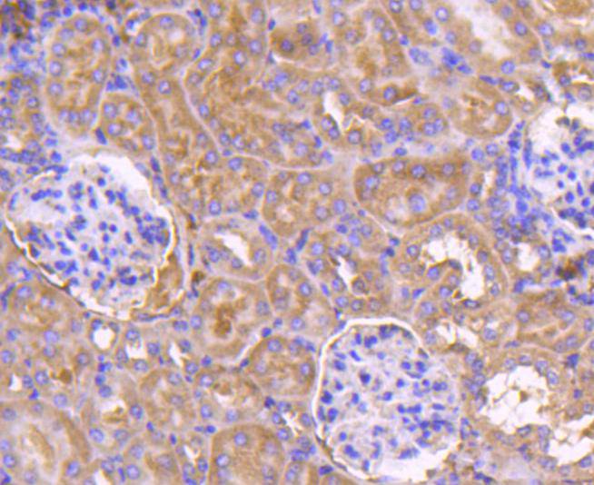 Immunohistochemical analysis of paraffin-embedded mouse kidney tissue using anti-PDPK1 antibody. The section was pre-treated using heat mediated antigen retrieval with Tris-EDTA buffer (pH 8.0-8.4) for 20 minutes.The tissues were blocked in 5% BSA for 30 minutes at room temperature, washed with ddH2O and PBS, and then probed with the primary antibody (ET1612-27, 1/50) for 30 minutes at room temperature. The detection was performed using an HRP conjugated compact polymer system. DAB was used as the chromogen. Tissues were counterstained with hematoxylin and mounted with DPX.