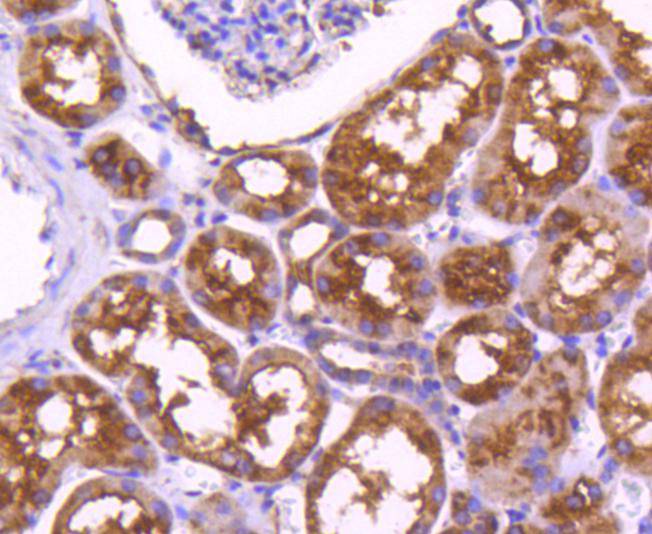 Immunohistochemical analysis of paraffin-embedded human kidney tissue using anti-PDPK1 antibody. The section was pre-treated using heat mediated antigen retrieval with Tris-EDTA buffer (pH 8.0-8.4) for 20 minutes.The tissues were blocked in 5% BSA for 30 minutes at room temperature, washed with ddH2O and PBS, and then probed with the primary antibody (ET1612-27, 1/50) for 30 minutes at room temperature. The detection was performed using an HRP conjugated compact polymer system. DAB was used as the chromogen. Tissues were counterstained with hematoxylin and mounted with DPX.