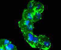 ICC staining pro Caspase 7 in Hela cells (green). The nuclear counter stain is DAPI (blue). Cells were fixed in paraformaldehyde, permeabilised with 0.25% Triton X100/PBS.
